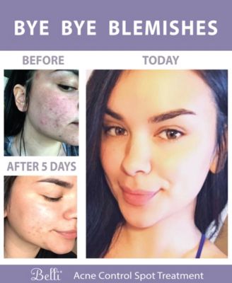 Fresh Start Pre-Treatment Scrub, 6.5 oz.