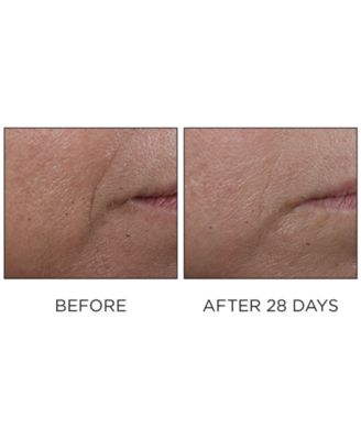 Cold Plasma Plus+ Advanced Serum Concentrate, 1 oz.