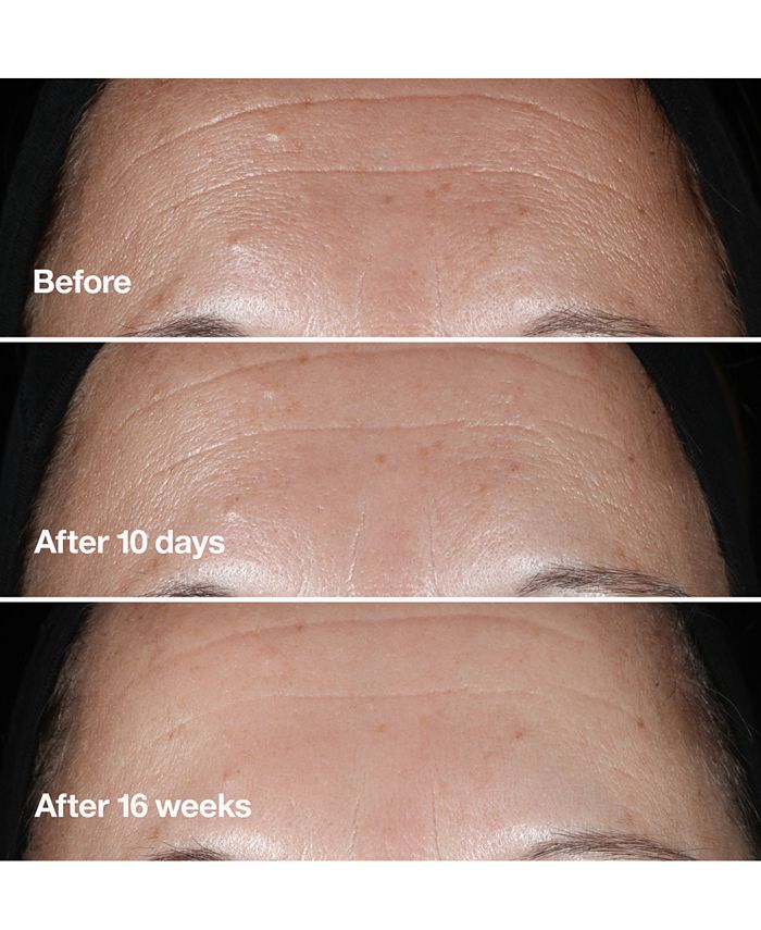 Clinique Smart Clinical Repair™ Wrinkle Correcting Serum, 1.7 oz. - Macy's