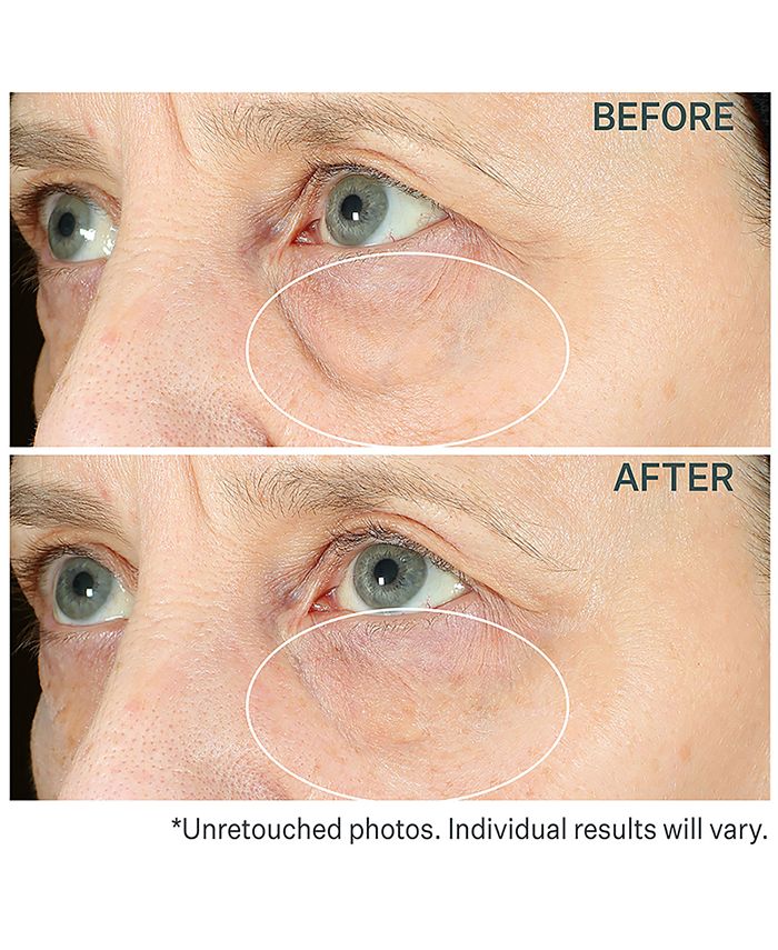 StriVectin Hyperlift Eye Instant Eye Fix - Macy's