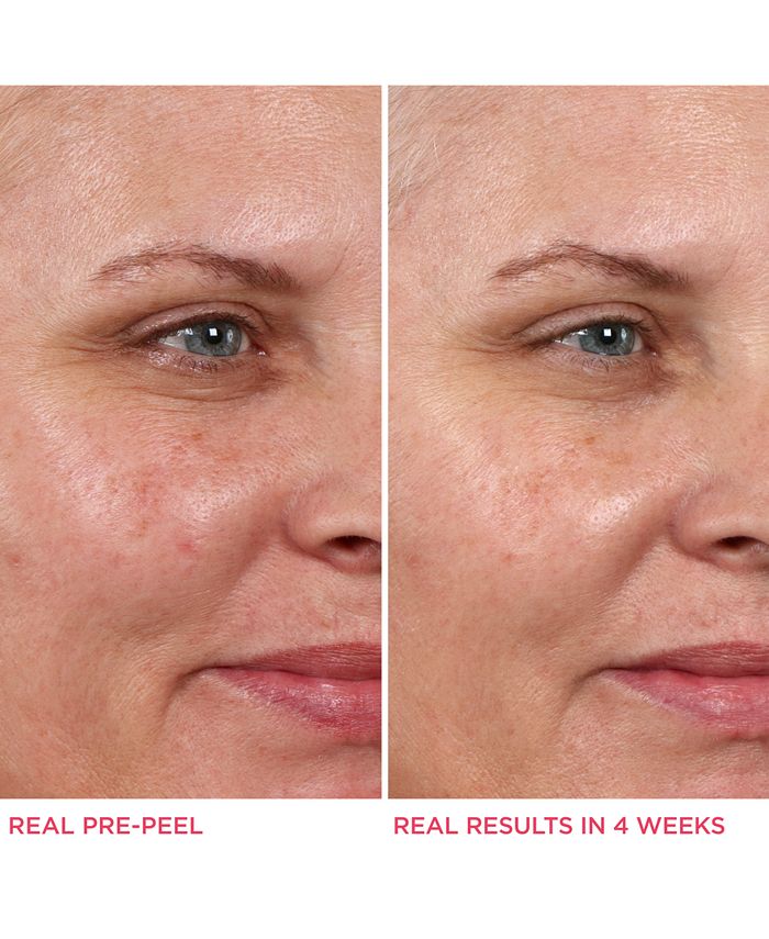 IT Cosmetics - Hello Results Baby-Smooth Glycolic Peel + Caring Oil