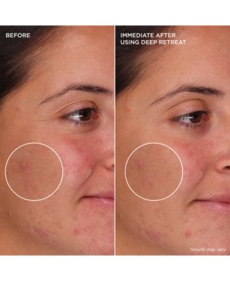 The POREfessional Deep Retreat Pore-Clearing Clay Mask