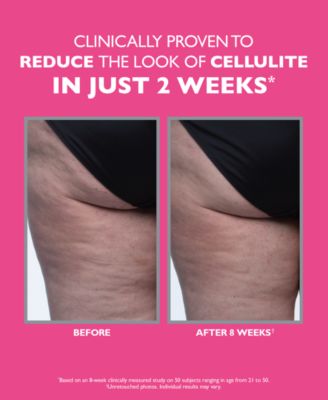 FIRMx Tight & Toned Body Treatment, 3.4 oz