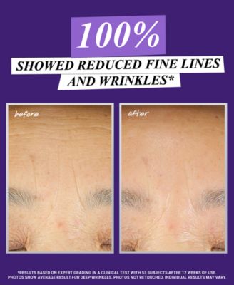 Micro-Dose Anti-Aging Retinol Serum with Ceramides and Peptide, 1-oz.