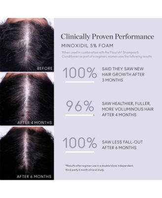 Minoxidil Topical Aerosol 5%, 2.11 oz.