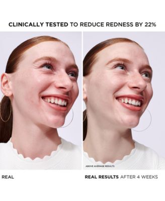 Bye Bye Redness Serum