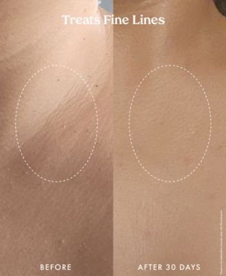 Ultra Renewal Retinol Body Cream, 4.7 oz.