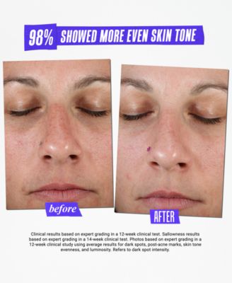 Dermatologist Solutions Clearly Corrective Dark Spot Solution, 3.4-oz.