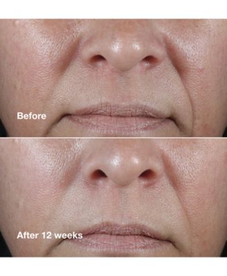 Smart Clinical Repair Wrinkle Correcting Rich Face Cream, 1.7 oz. 