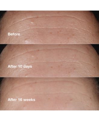 Smart Clinical Repair Wrinkle Correcting Serum Mini, 0.34 oz.