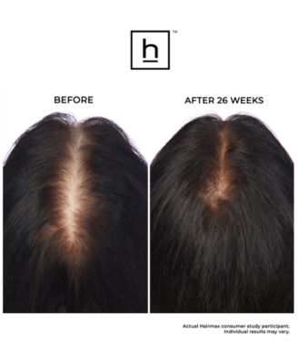 Laserband 41 Comfortflex