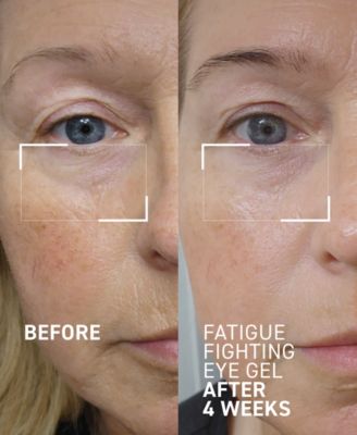 Fatigue Fighting Eye Gel, 0.5 oz.
