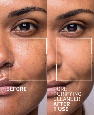 Pores No More Pore Purifying Cleanser