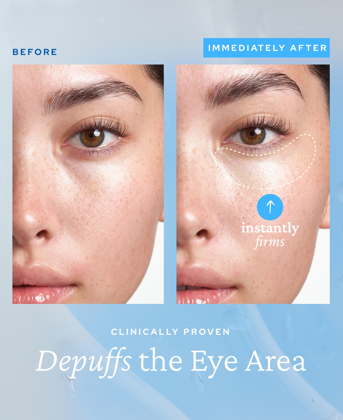 Belif Aqua Bomb Depuffing Eye Gel With Caffeine + Hyaluronic Acid 0.5 oz / 15 ml In No Color
