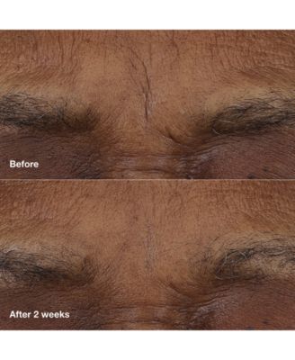 Smart Clinical Repair AM/PM Retinoid Balm, 0.12 oz