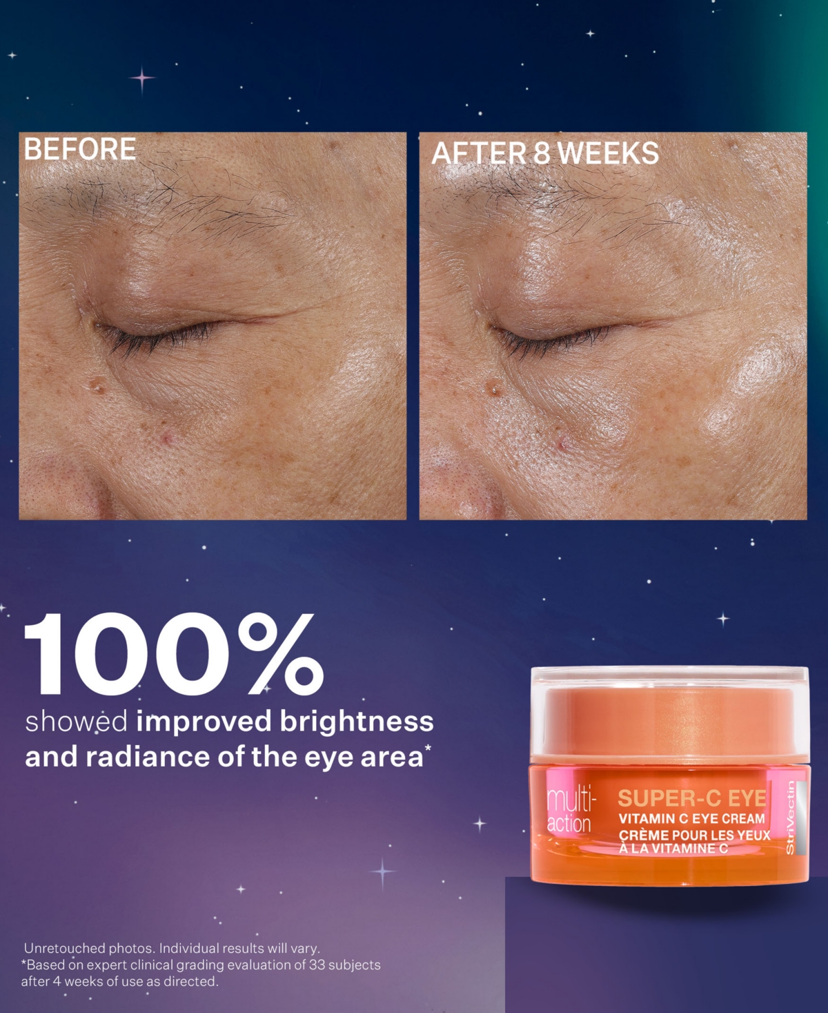 StriVectin 3-Pc. Brighten & Rejuvenate Skincare Set