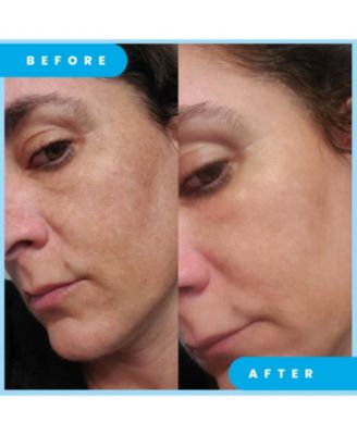 Dark Spot Corrector Remover for Face Ultra Potent Brightening Serum