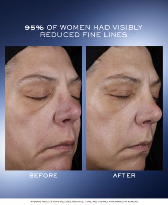 G&eacute;nifique Ultimate Recovery Face Serum, 3.9 oz.