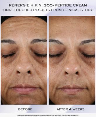 3-Pc. R&eacute;nergie H.C.F. Triple Serum Discovery Set