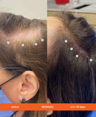 Revita High-Performance Hair Density Shampoo Refill, 500 ml