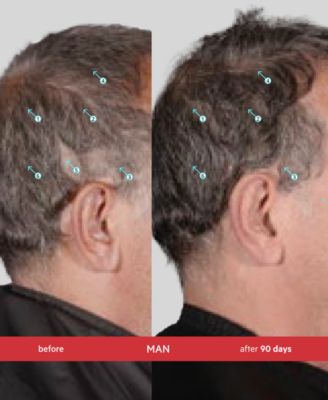 Spectral.DNC-S Extra Strength Anti-Gray Hair Density Serum, 2 oz.