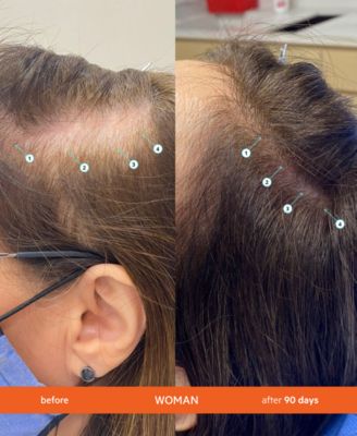 REVITA High-Performance Hair Density Shampoo, 925 ml