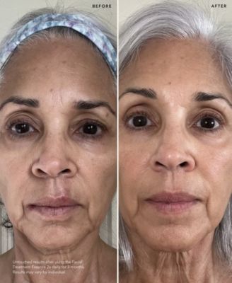 Facial Treatment Essence, 2.5 oz.