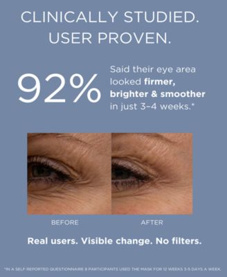 Solaries Laboratories NY LED Light Therapy + Targeted Vibration Eye Rejuvenation Device