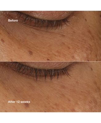 All About Eyes Brightening Serum Concentrate With Retinoid, 10 ml