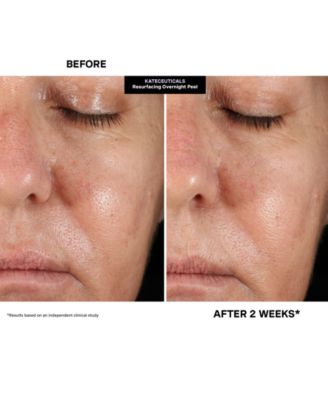 KateCeuticals Resurfacing Overnight Peel, 1 oz.