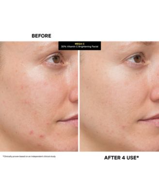 Mega-C 30% Vitamin C Brightening Facial, 2 oz.