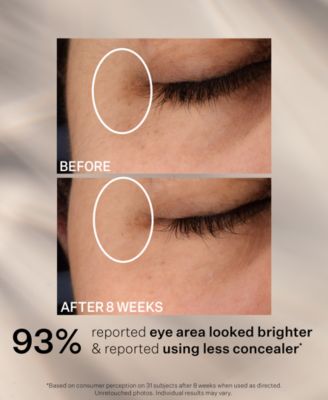 Super-C Dark Circle Brightening Eye Serum