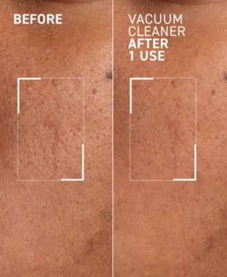 Pores No More Vacuum Cleaner Pore Purifying Mask, 1-oz.