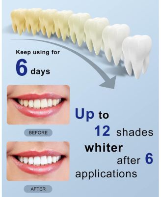Teeth Whitening Kit with led Light, 28X Teeth Whitening Strips for Teeth Sensitive, 10 Min Fast Whitening , Helps to Remove Stains from Coffee, Smoking, Wines (1Pcs Light + 14Sets Strips)