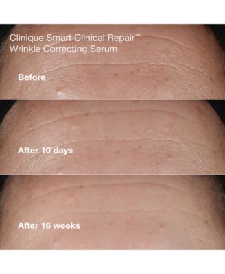 Wrinkle-Fighting Routine Skin Care Gift Set