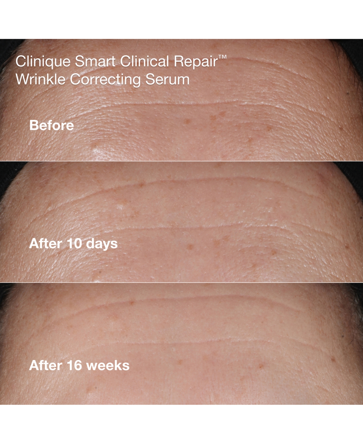 Clinique 4-pc. Wrinkle-fighting Routine Skin Care Set In Transparent