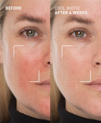 Cool Biotic Prebiotic Redness Relief Cream