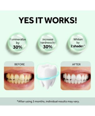 Nano-Hydroxyapatite Toothpaste for Sensitive Teeth - Supports Enamel Health, Fluoride Free Natural Toothpaste for Adults, Misty Mint, 4.2 oz