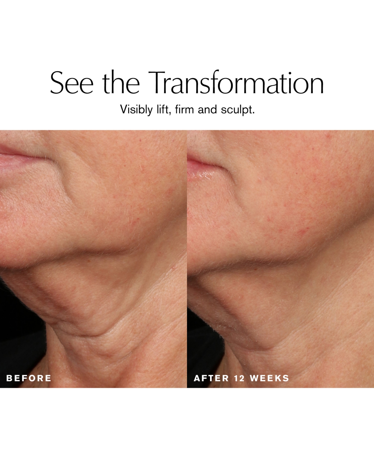 Estee Lauder Revitalizing Supreme + Sculpting Serum, 1.7 oz.