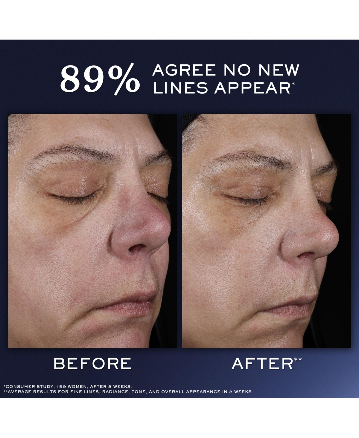 Lancome Genifique Ultimate Recovery Face Serum