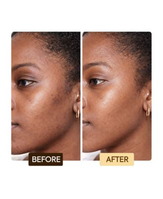 Exclusive Dark Spot Corrector Serum - 1.66oz