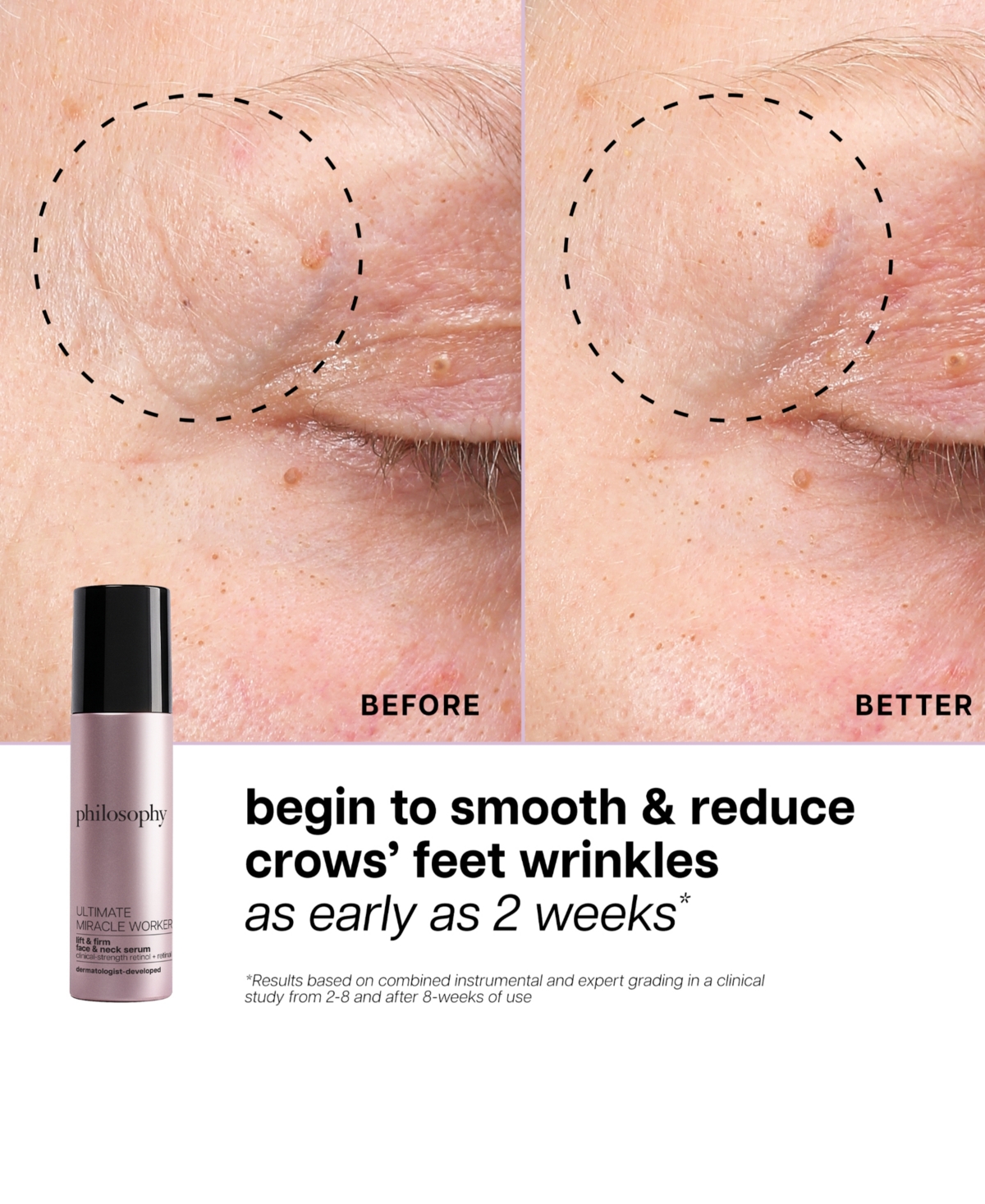 philosophy Ultimate Miracle Worker Lift and Firm Face and Neck Serum, 1.6 oz.