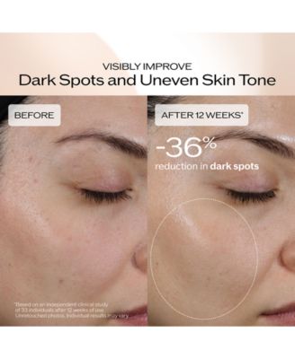 Benefiance Dark Spot and Wrinkle Smoothing Serum, 1 oz.