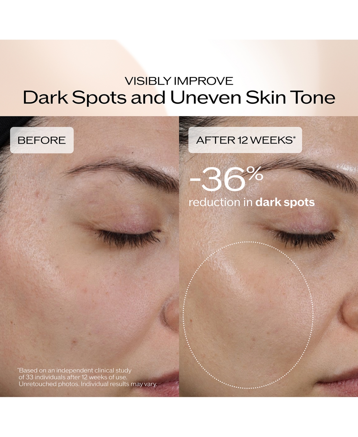 Shiseido Benefiance Dark Spot and Wrinkle Smoothing Serum, 1 oz.