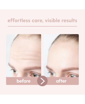 Forehead Wrinkle Patches | Multi-use Silicone Wrinkle Patches for Face Overnight | Facial Patches for Forehead Lines & Smoother Skin