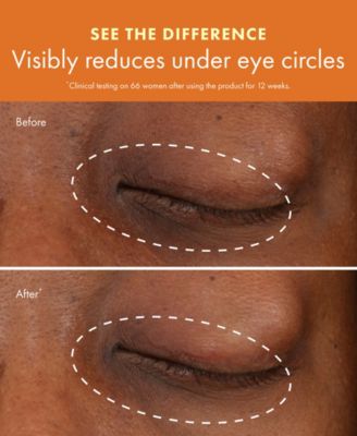 GinZing Brightening Eye Cream with Vitamin C & Niacinamide