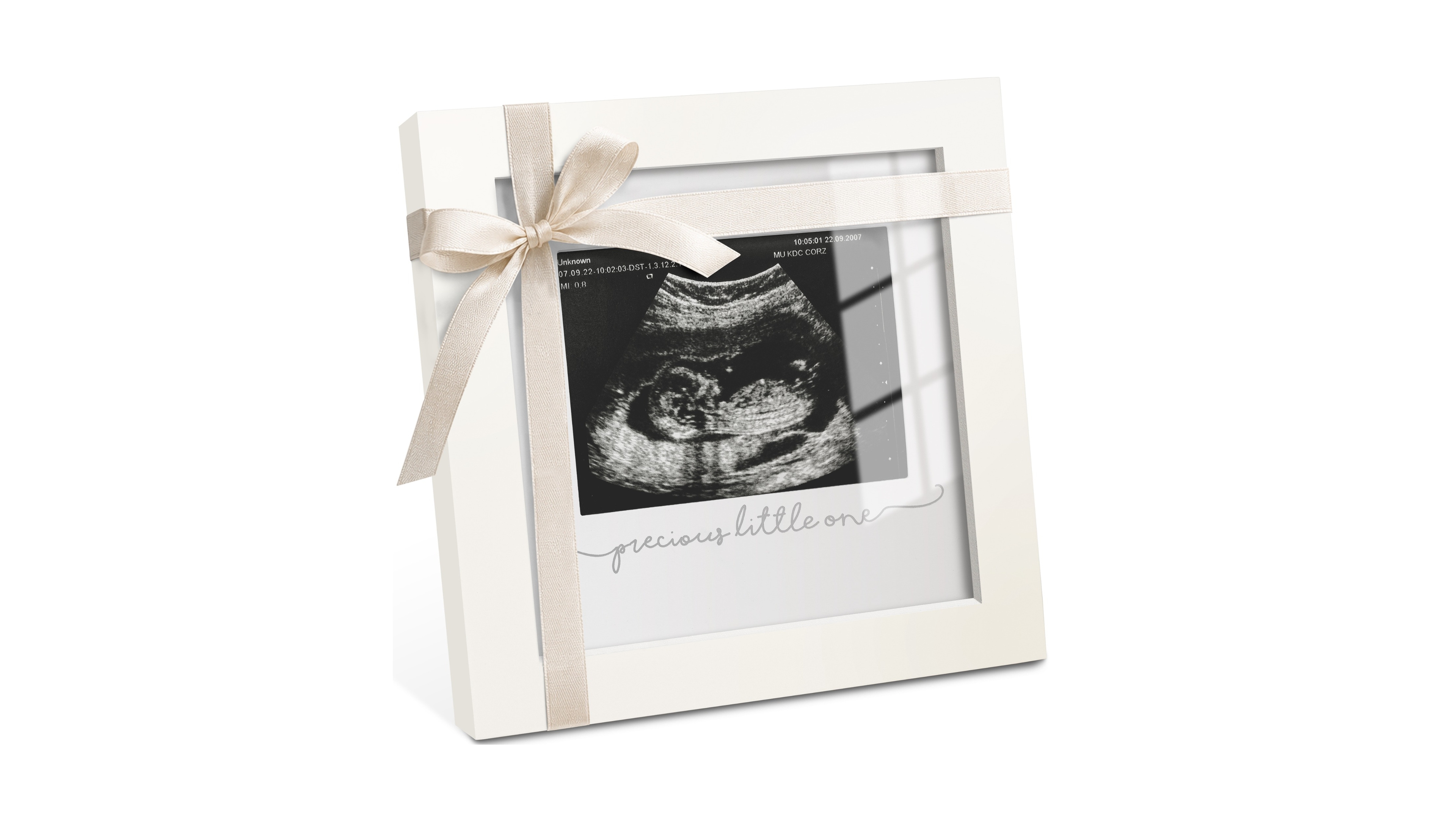 Solo Baby Sonogram Picture Frame, Modern Ultrasound Frames, Pregnancy Announcements Frame