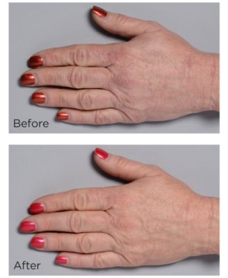 Cold Plasma Plus+ Hand Therapy, 2-oz.