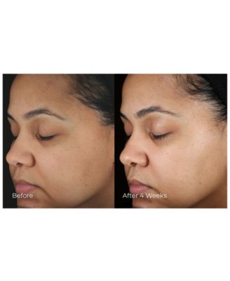 BeautyStat Universal Pro-Bio Moisture Boost Cream, 1-oz.