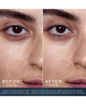 Lancôme 2-Pc. Advanced Génifique Serum & Eye Cream Set